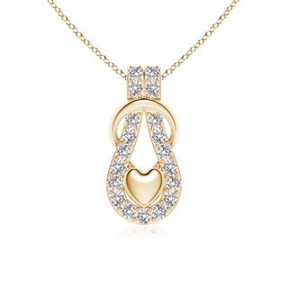 Round I-J, I1-I2 Diamond