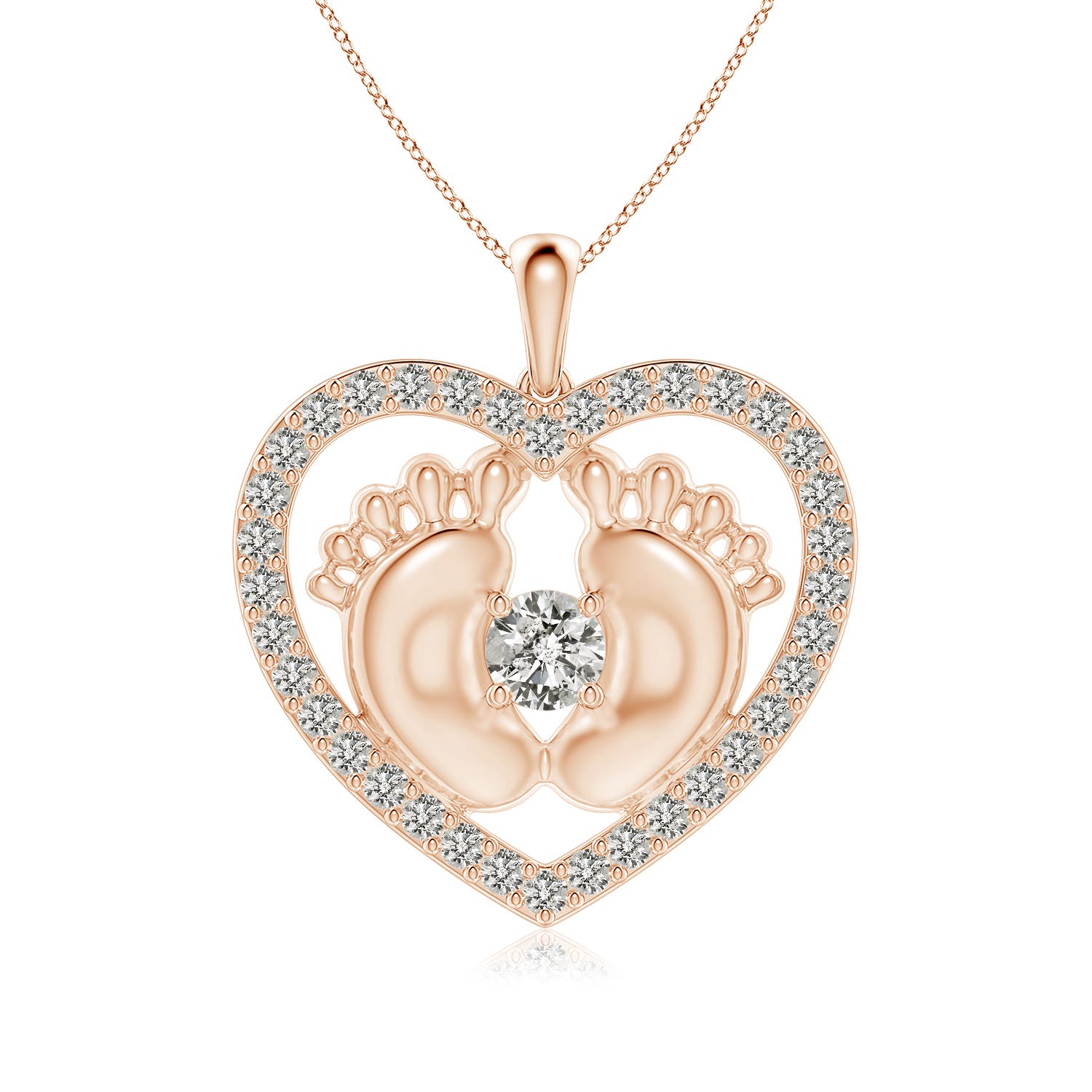 K, I3 / 1.54 CT / 14 KT Rose Gold